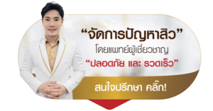 รักษาสิวกับแพทย์