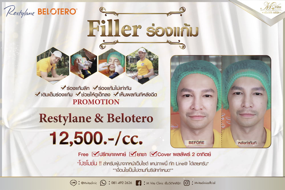 filler ราคา