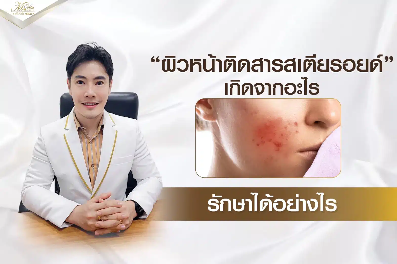 ผิวหน้าติดสารสเตียรอยด์