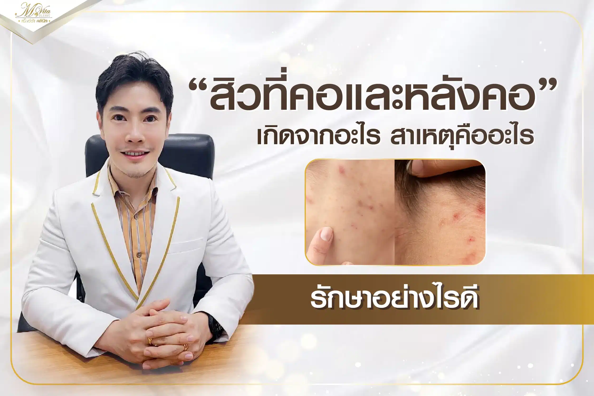 สิวที่คอและหลังคอเกิดจากอะไร สาเหตุคืออะไร รักษาอย่างไรดี