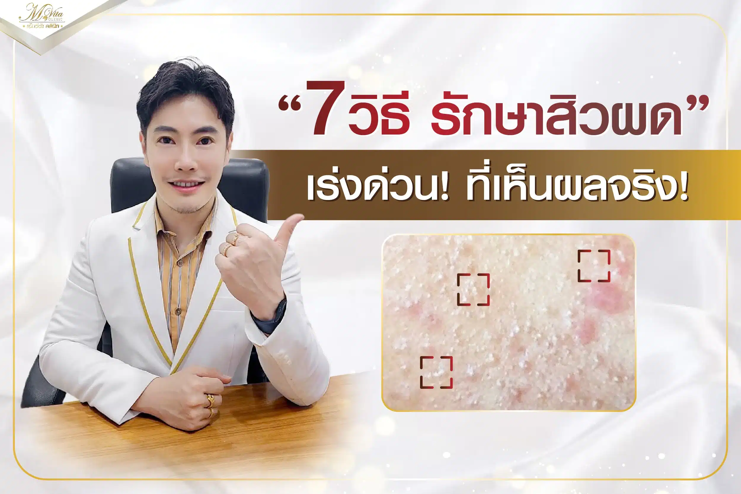 ไขข้อสงสัย สิวผด คืออะไร รักษาให้หายได้อย่างไร