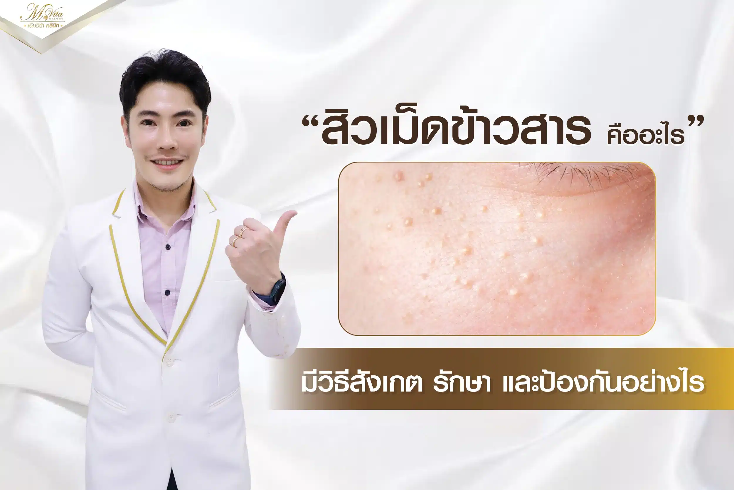 สิวเม็ดข้าวสาร (Milia) คืออะไร ใช่สิวจริงๆ หรือเปล่า?