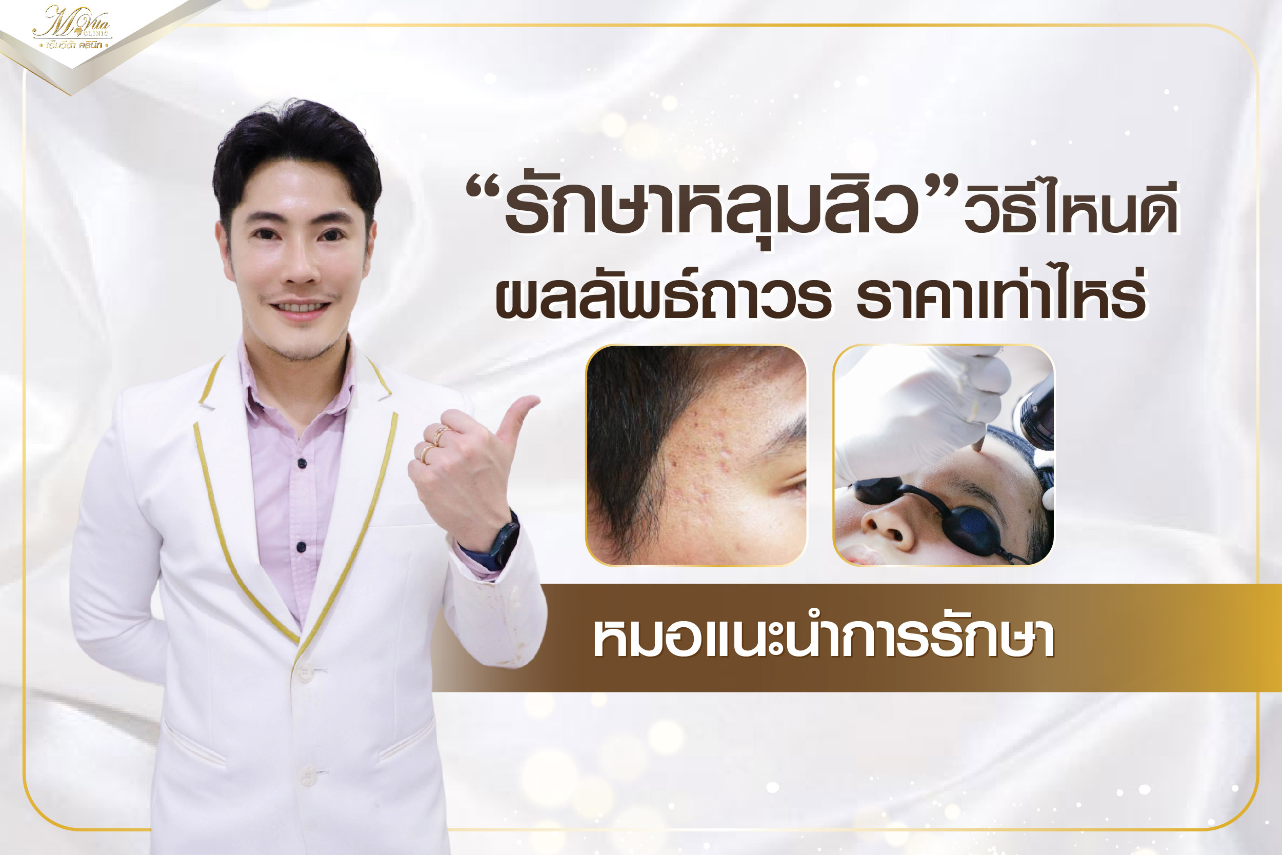 รักษาหลุมสิว วิธีไหนดี ผลลัพธ์ถาวร ราคาเท่าไหร่ หมอแนะนำการรักษา