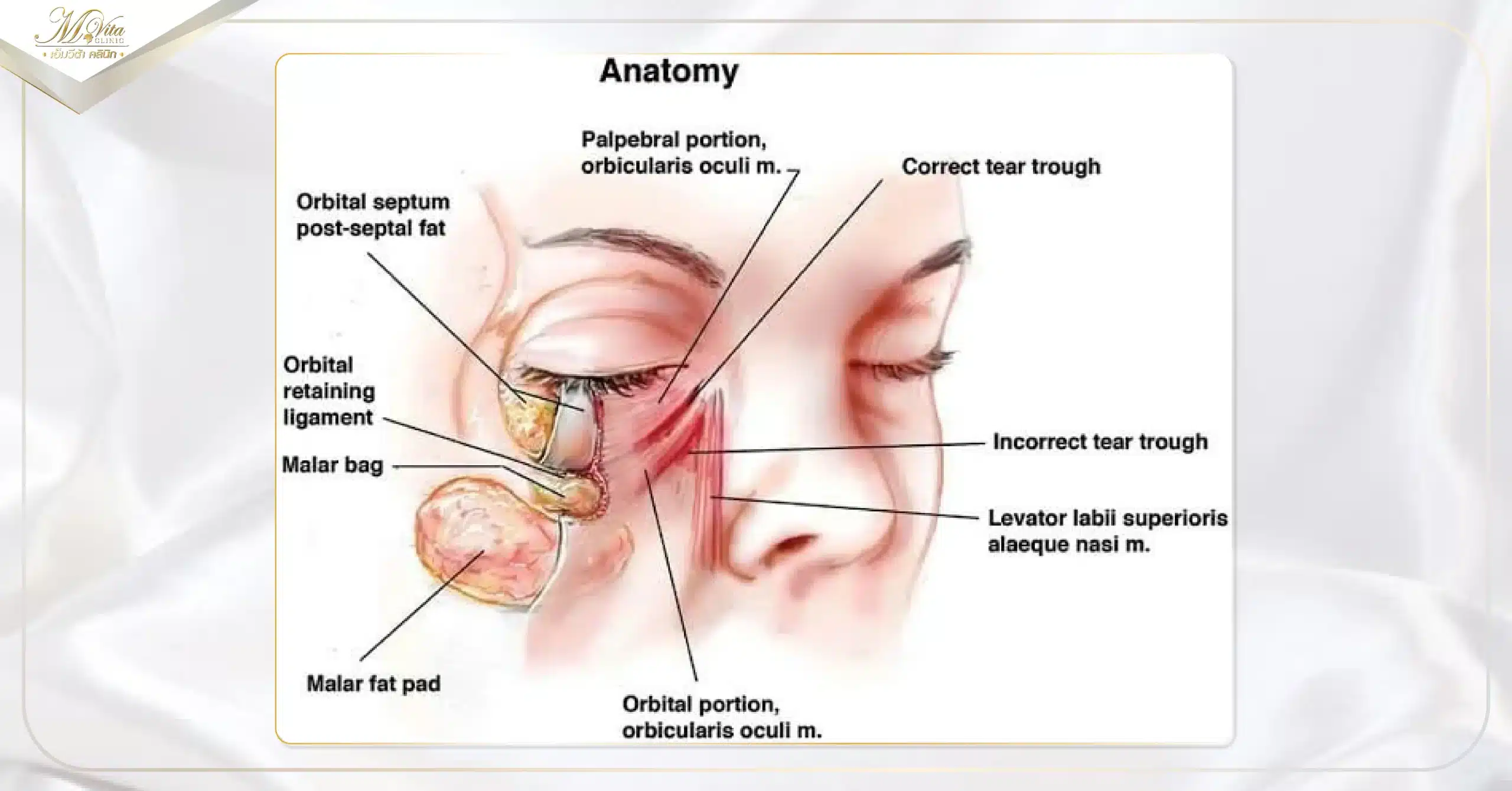 ร่องใต้ตาลึก เกิดจากอะไร 2