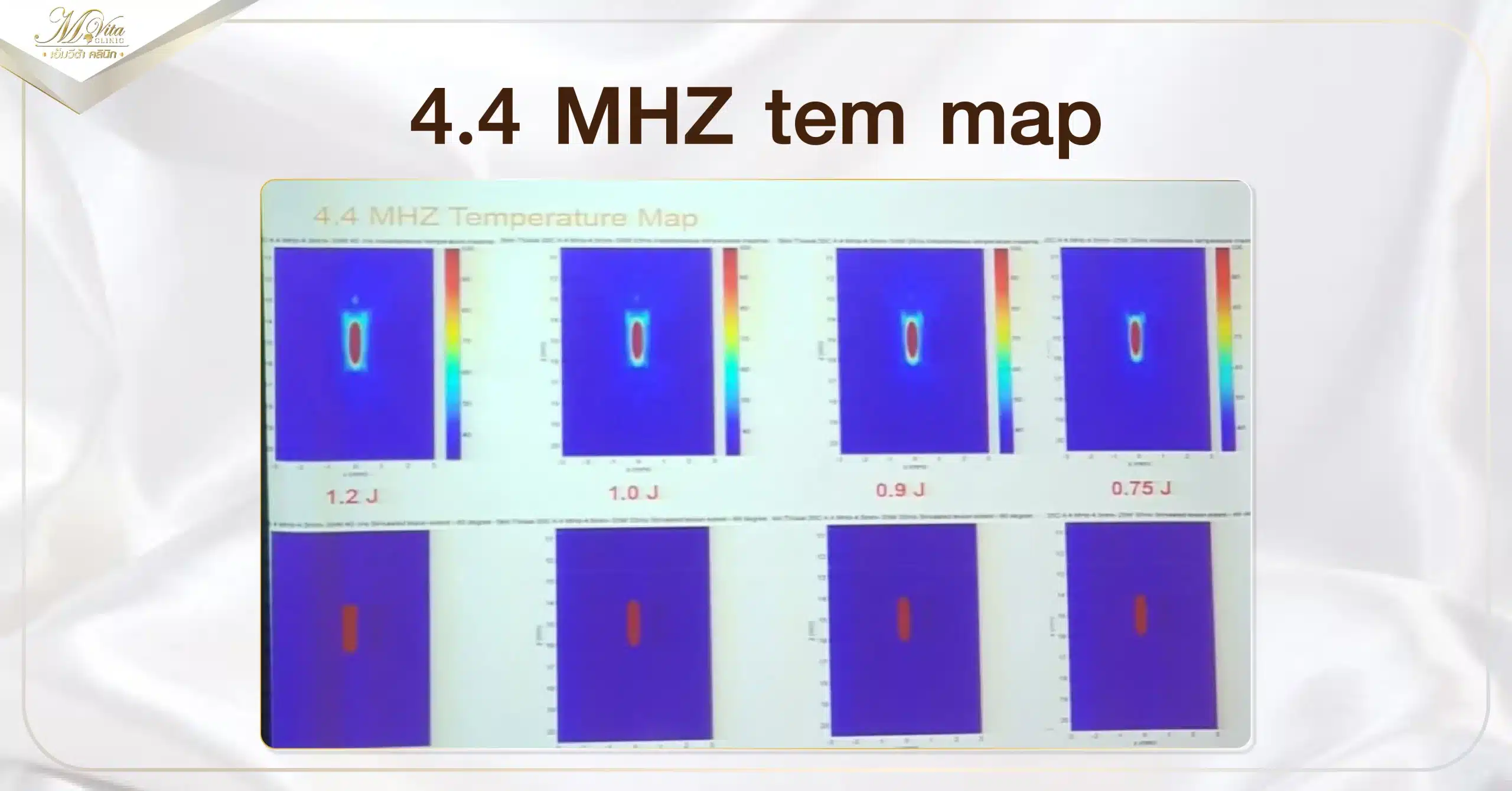 4.4 MHZ tem map