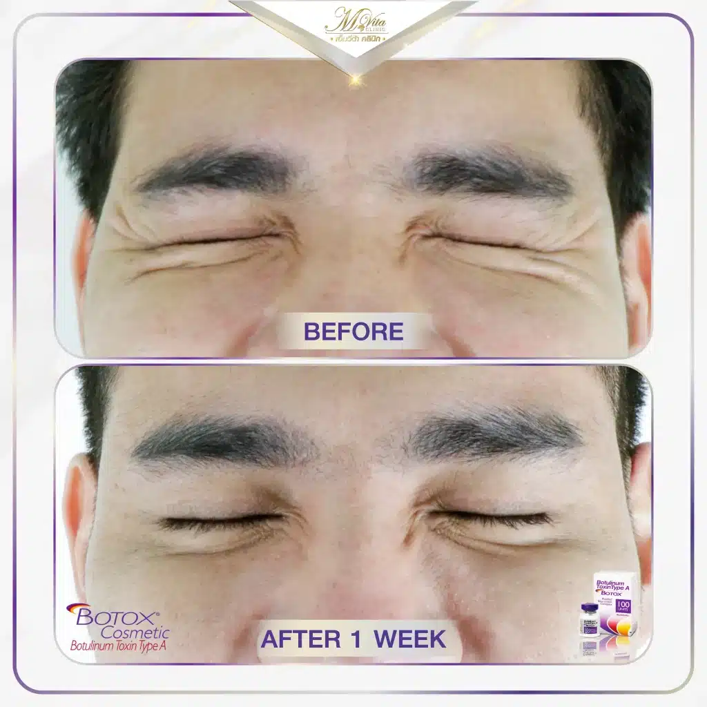 Allergan M Vita Clinic-02