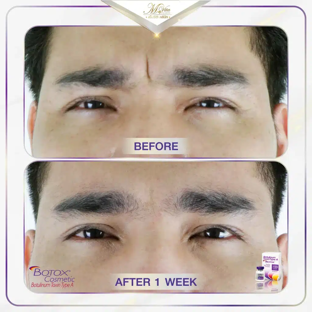 Allergan M Vita Clinic-03