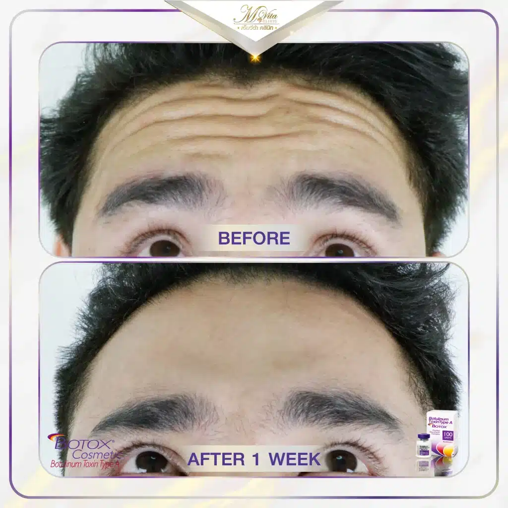 Allergan M Vita Clinic-04