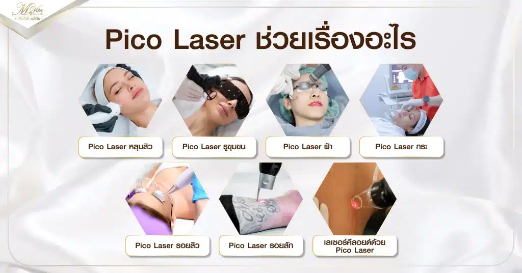 Pico Laser ช่วยเรื่องอะไร2