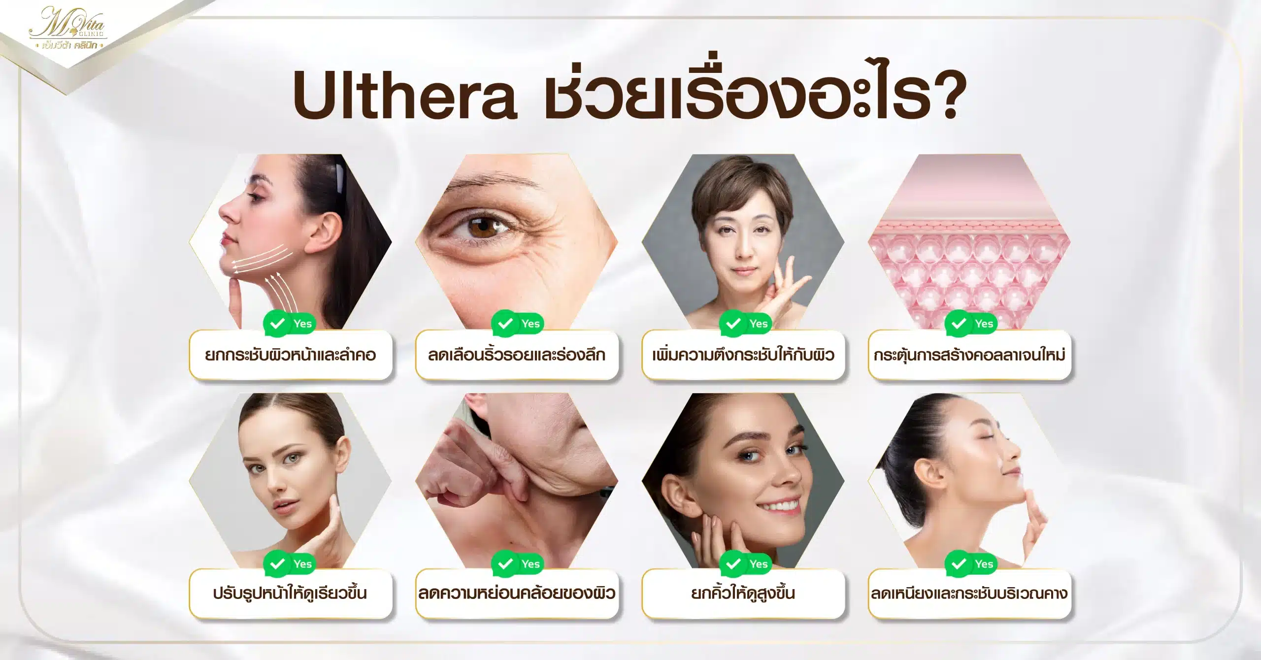 Ulthera ช่วยเรื่องอะไร