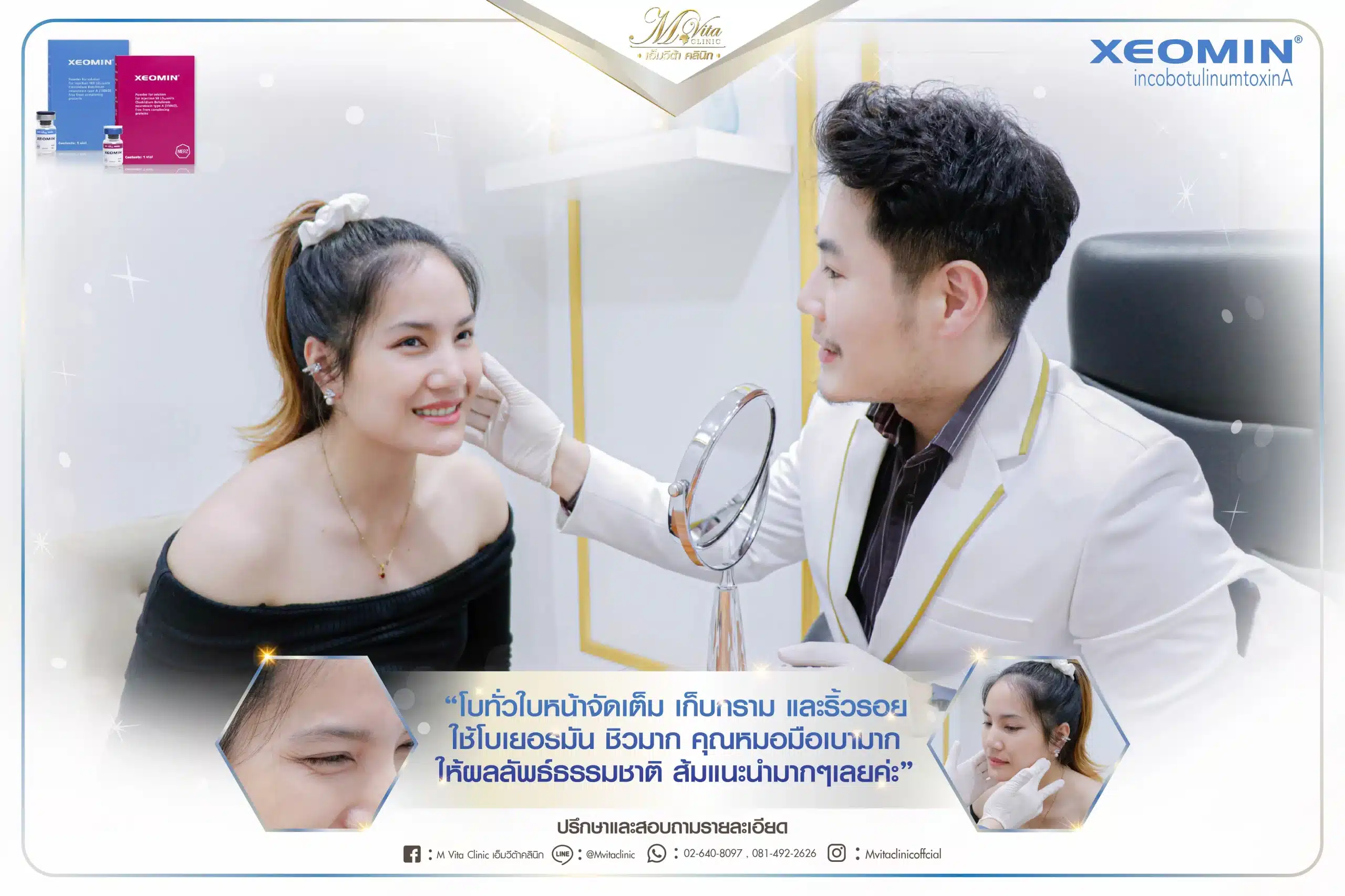 Xeomin รีวิว-05