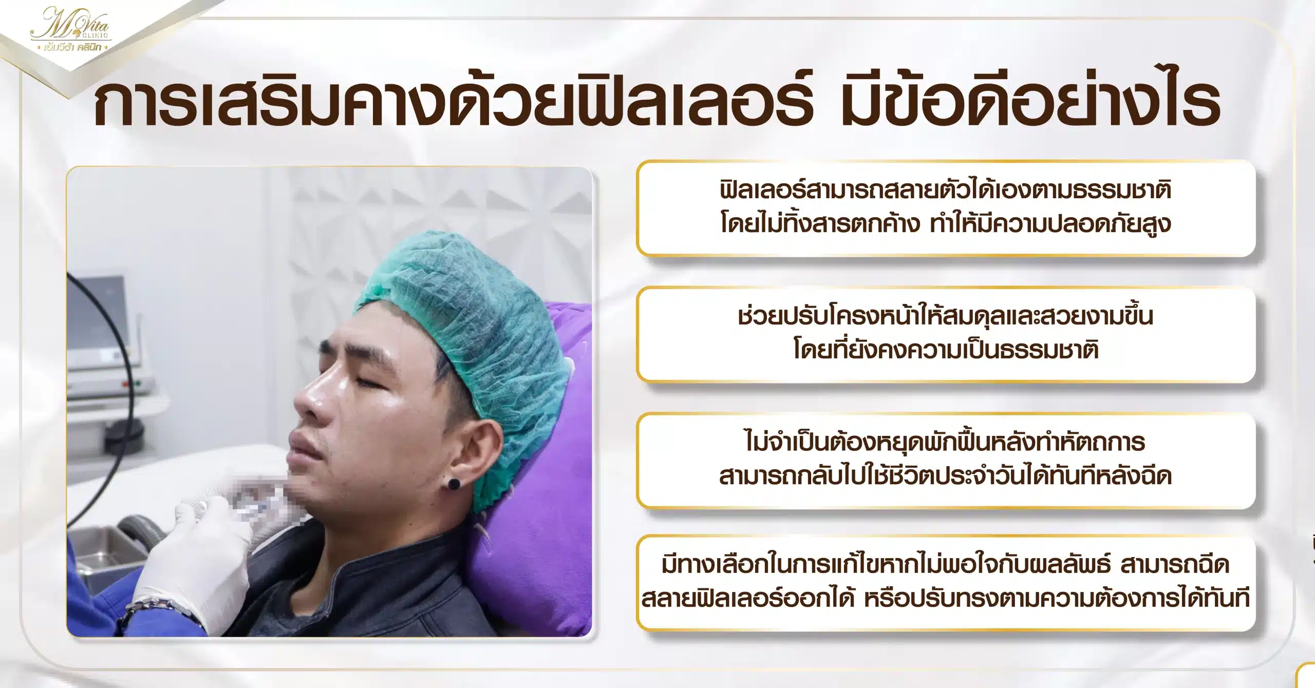 การเสริมคางด้วยฟิลเลอร์ มีข้อดีอย่างไร