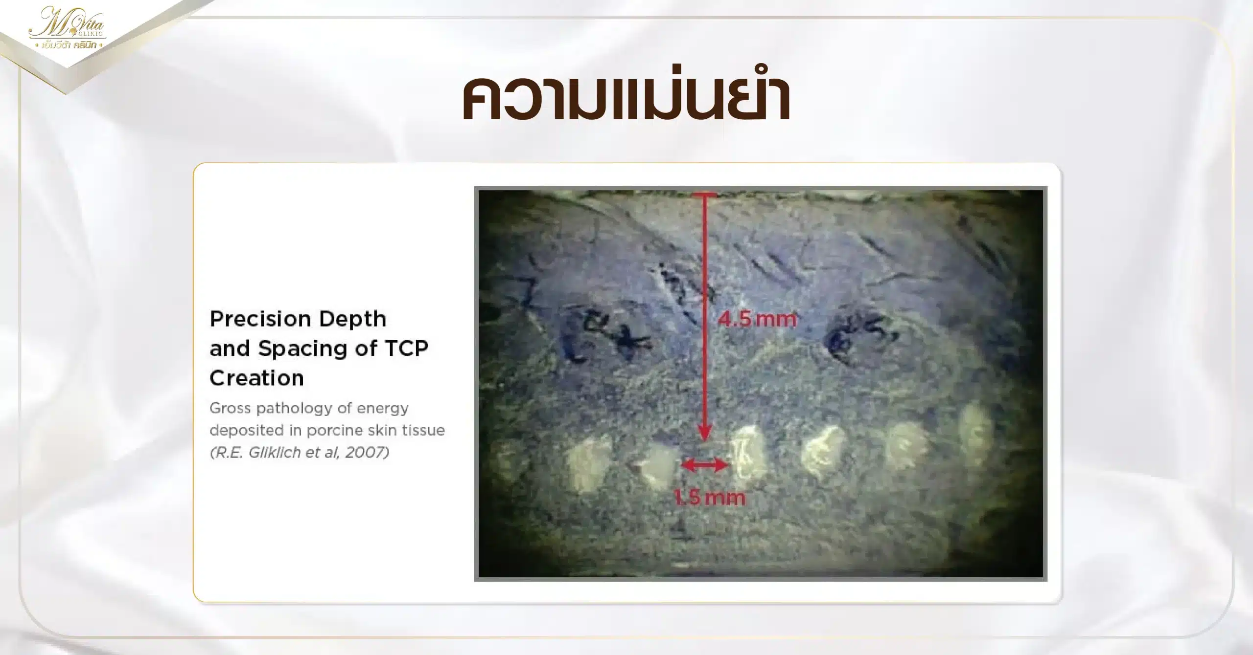 ความแม่นยำ