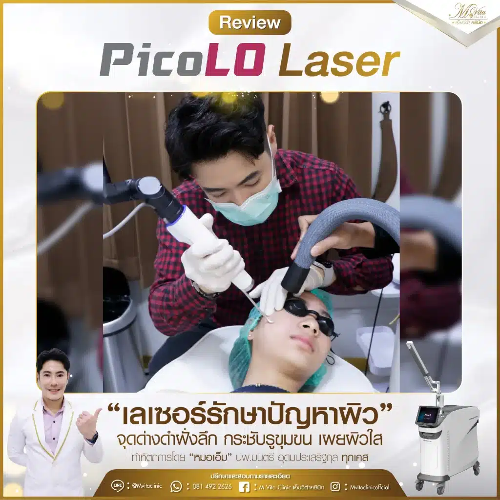 รีวิว pico laser 5-01-01