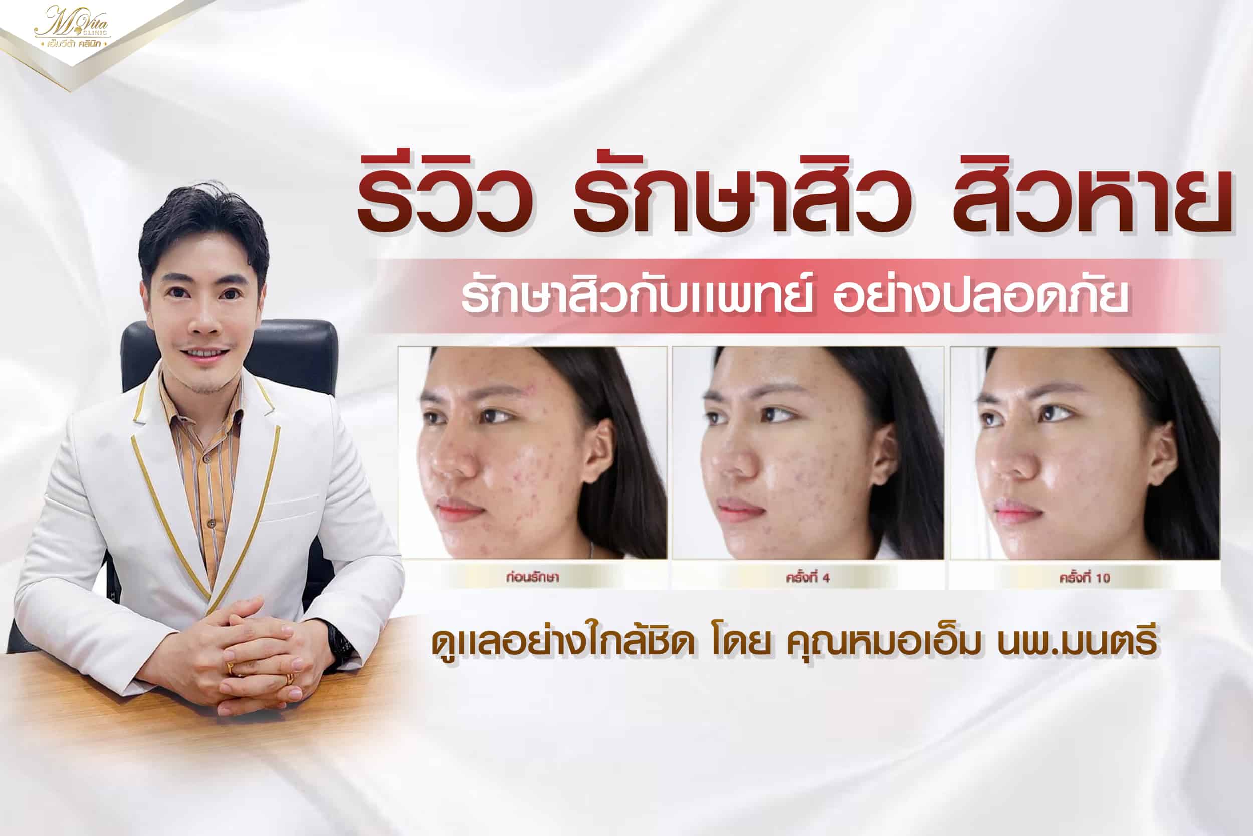 รีวิว รักษาสิว สิวหาย รักษาสิวกับแพทย์ อย่างปลอดภัย การันตีผลลัพธ์ ที่ เอ็มวีต้า คลินิก