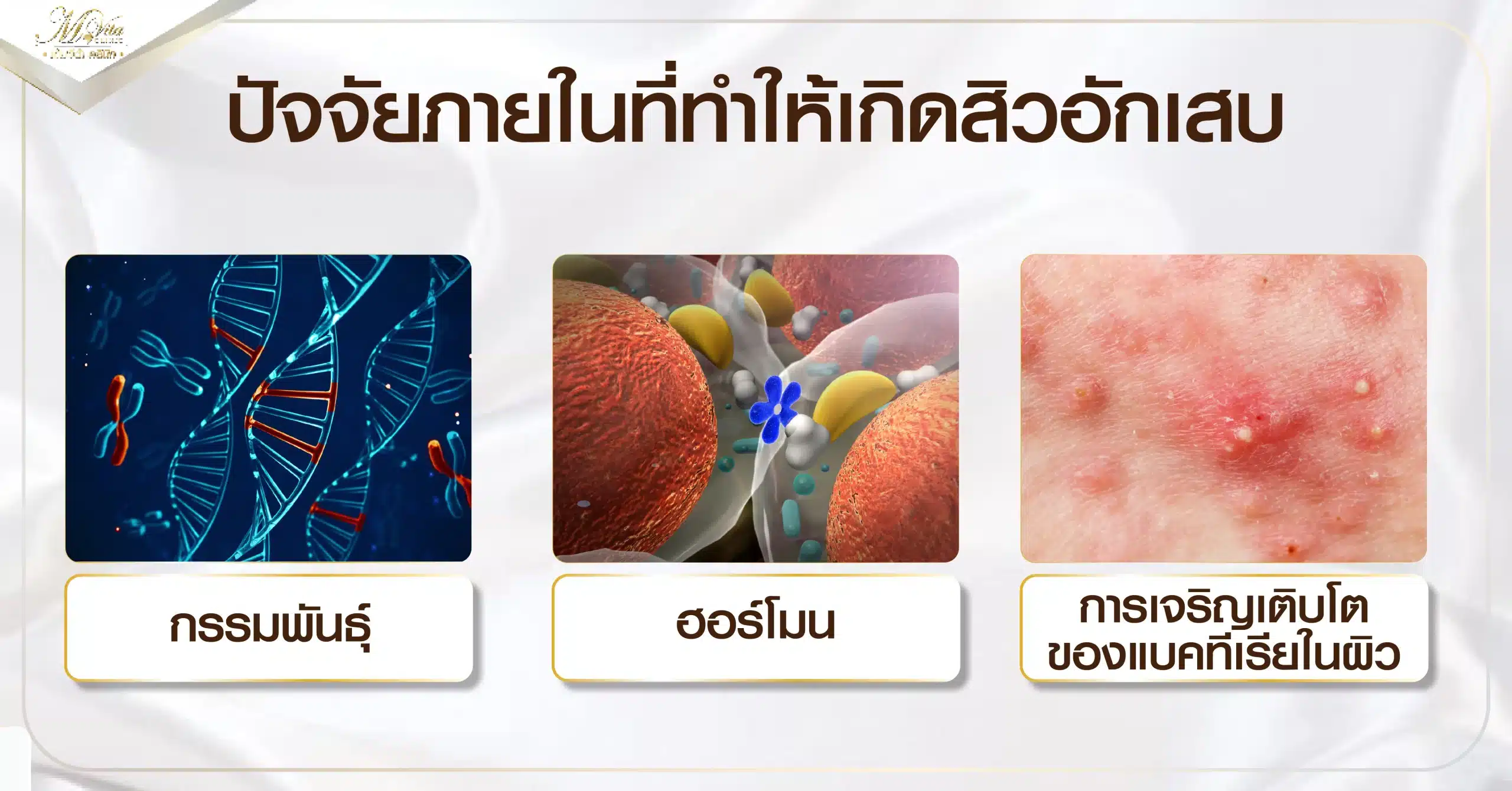 ปัจจัยภายในที่ทำให้เกิดสิวอักเสบ