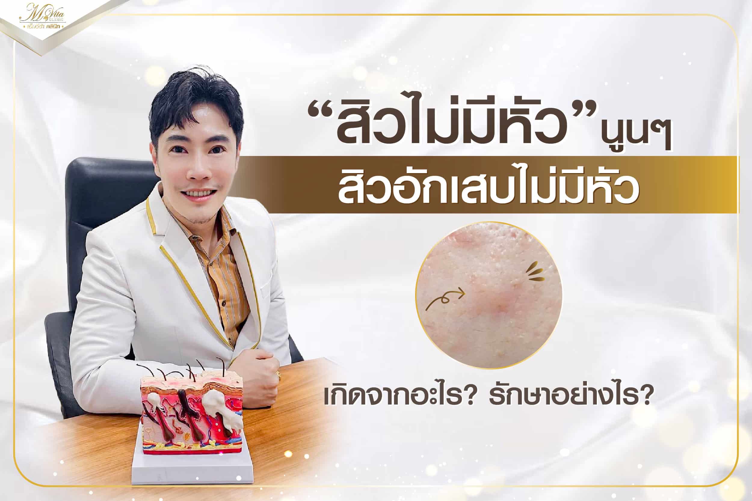 สิวไม่มีหัว นูนๆ สิวอักเสบไม่มีหัว เกิดจากอะไร? รักษาอย่างไร?