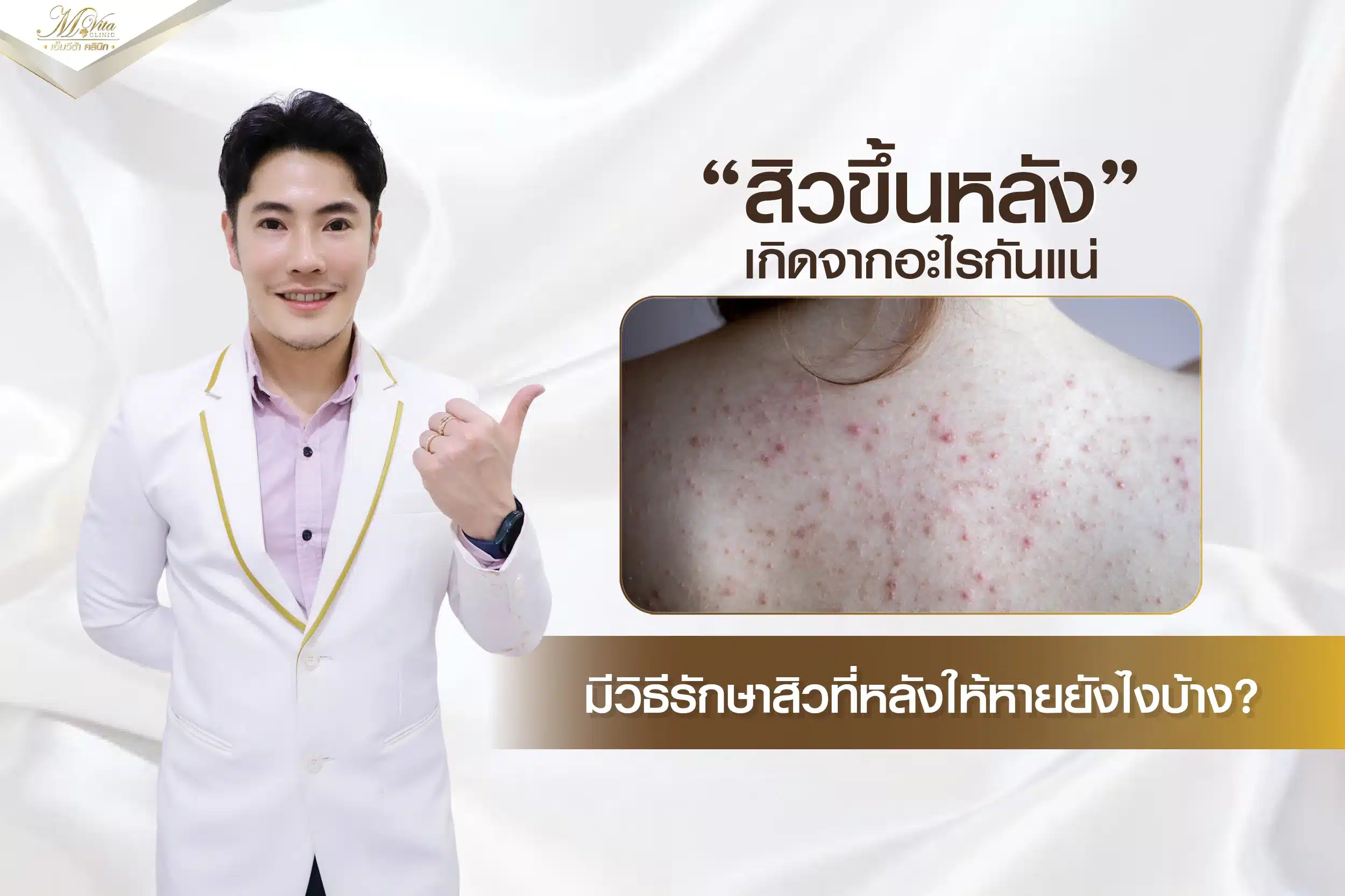 ทำความรู้จักสาเหตุของสิวขึ้นหลัง และวิธีรักษาให้หาย