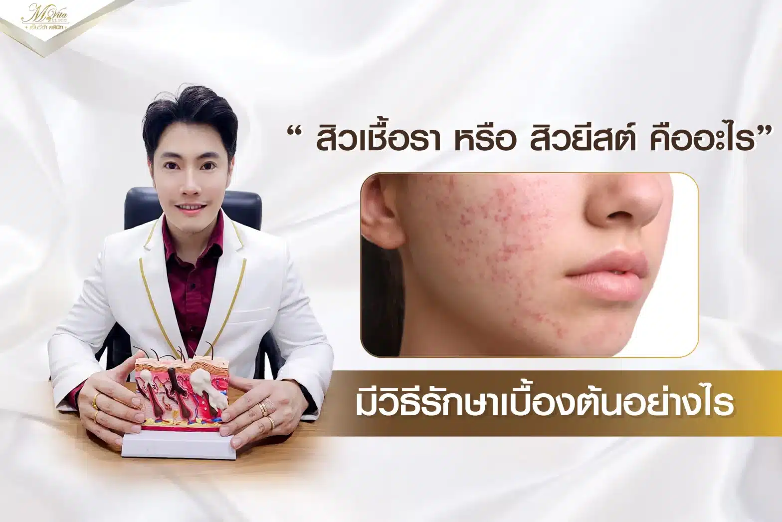 สิวเชื้อรา หรือ สิวยีสต์ คืออะไร