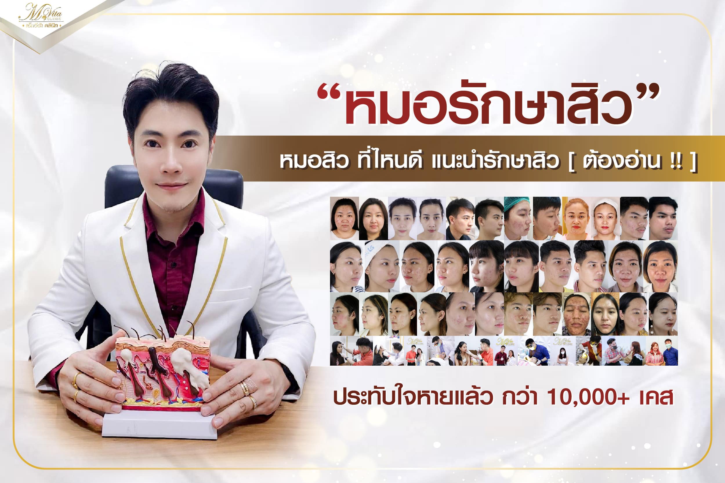 หมอรักษาสิว หมอสิว ที่ไหนดี แนะนำรักษาสิว [ ต้องอ่าน !! ] คนไข้ของคุณหมอ กว่า 10,000+ เคส