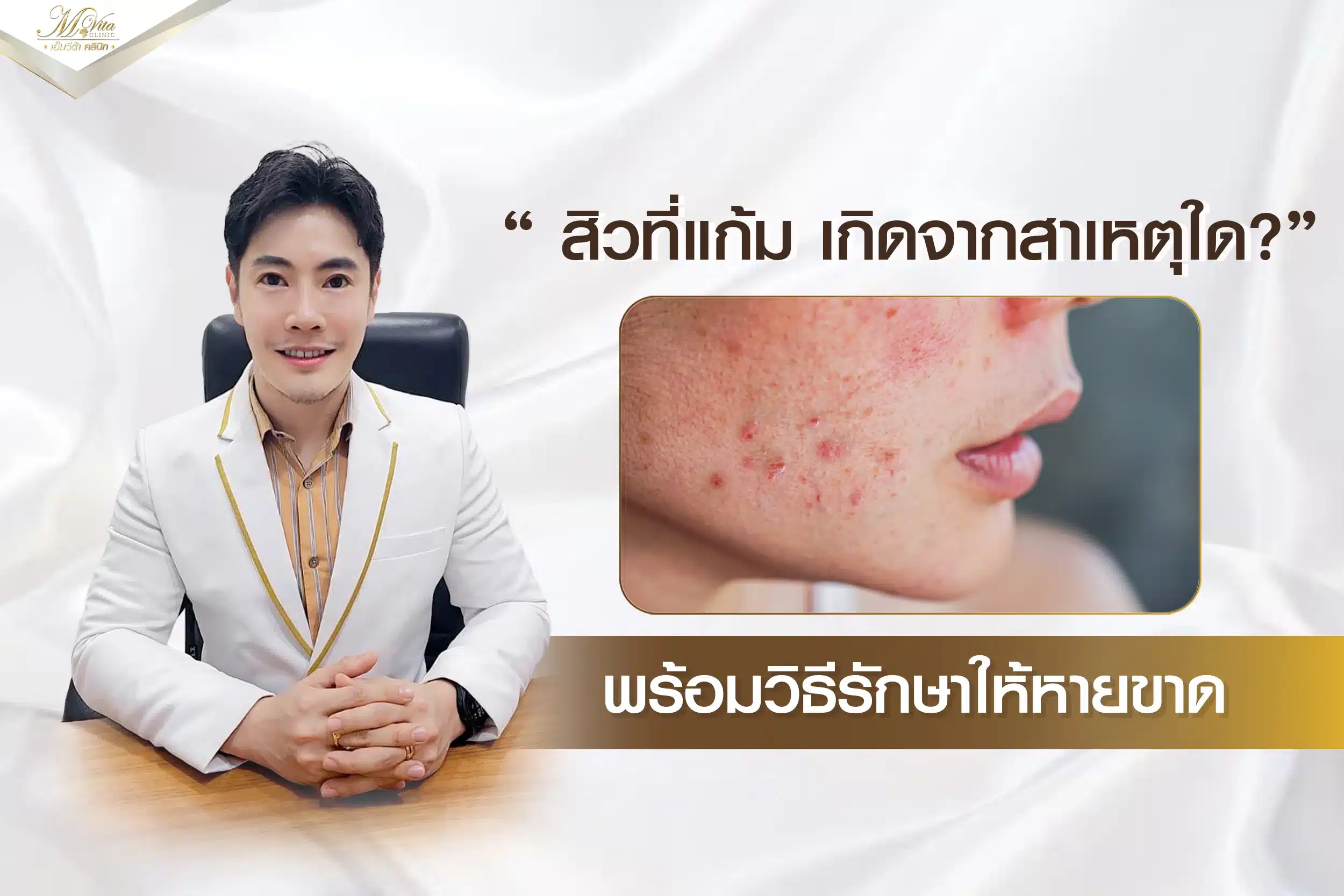 สิวที่แก้ม เกิดจากสาเหตุใด พร้อมวิธีรักษาให้หายขาด