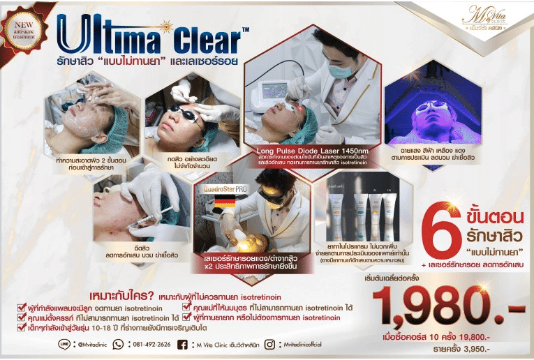Ultima-Clear