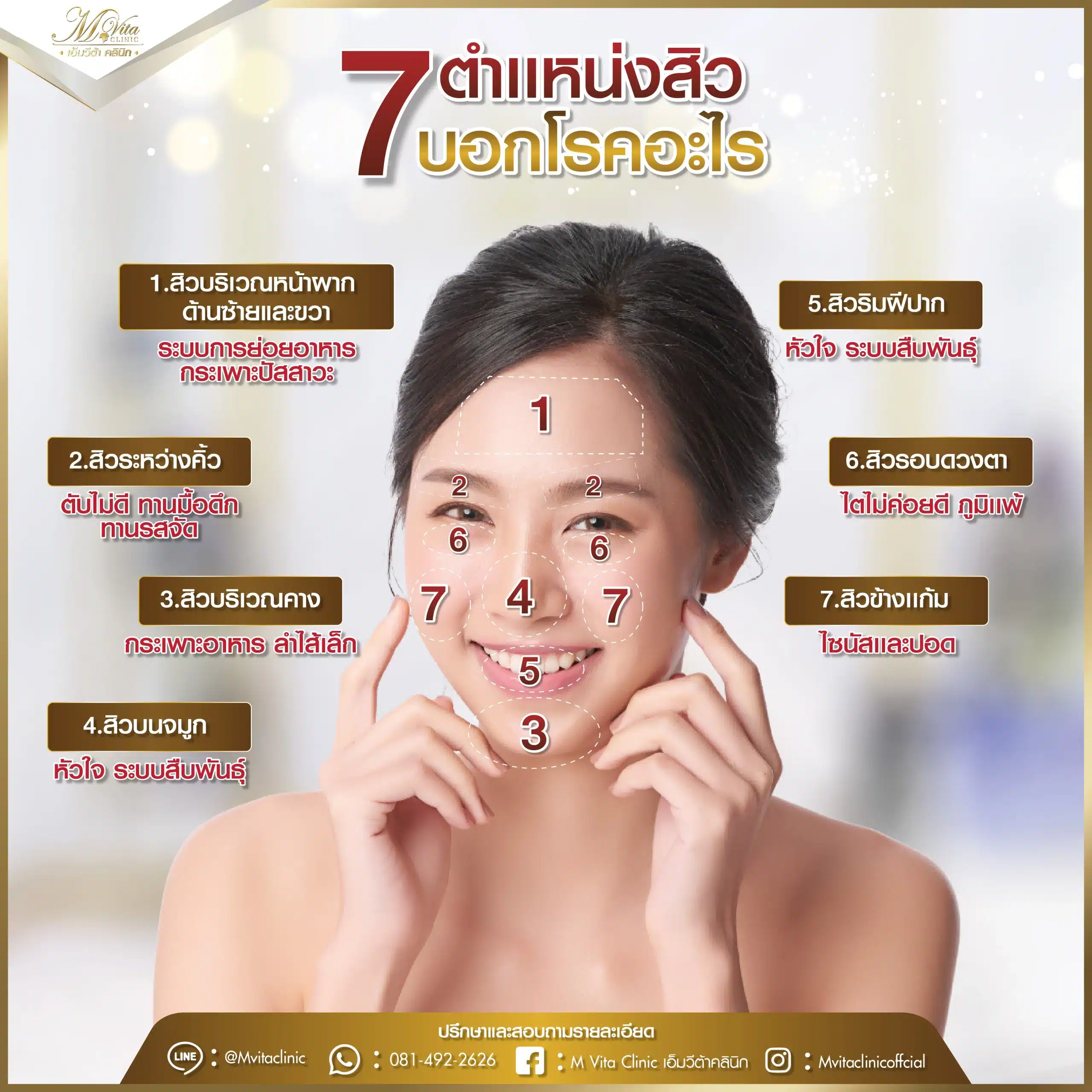 7 ตำแหน่งสิวบนใบ บอกโรคอะไร