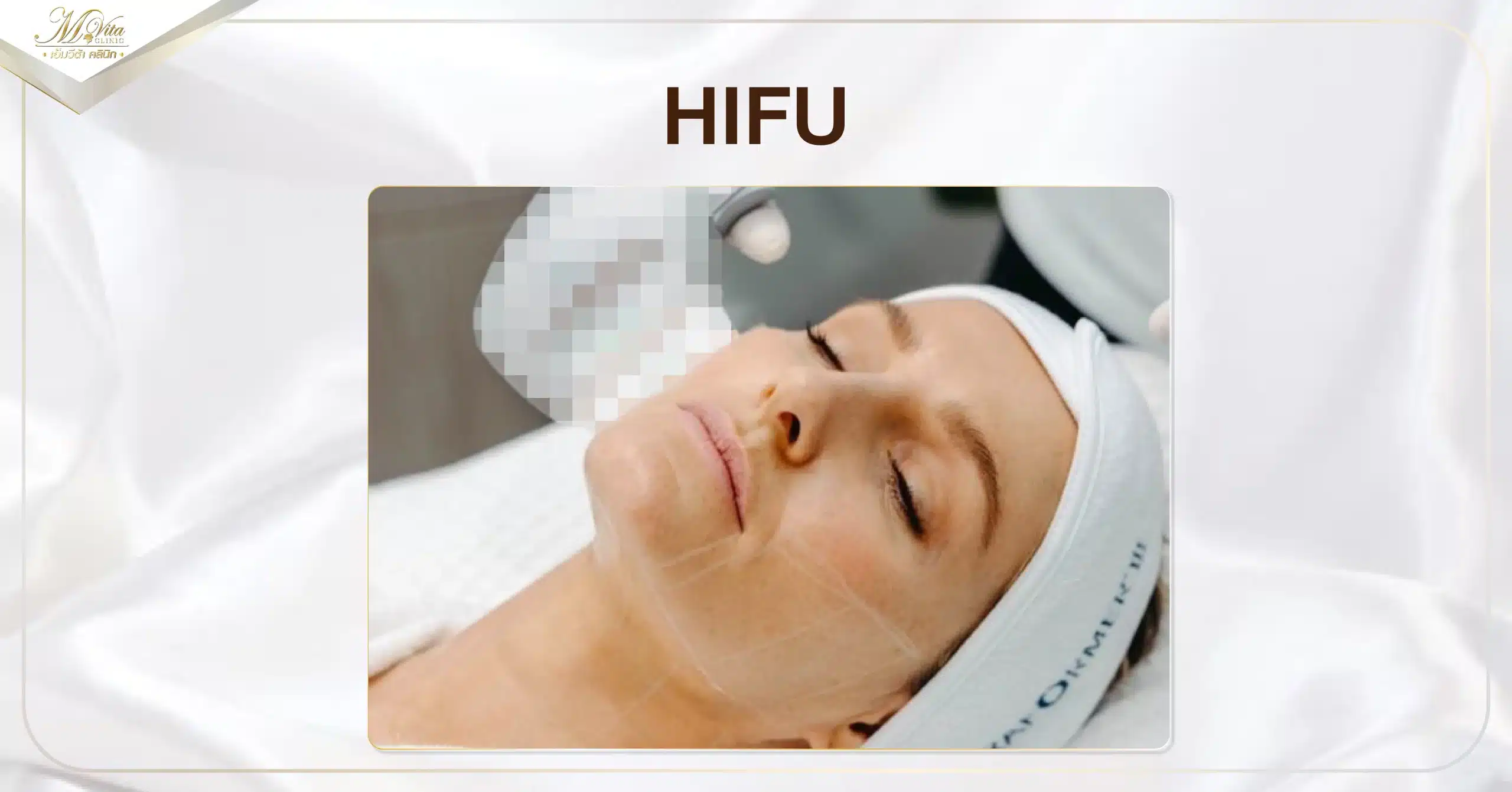 HIFU