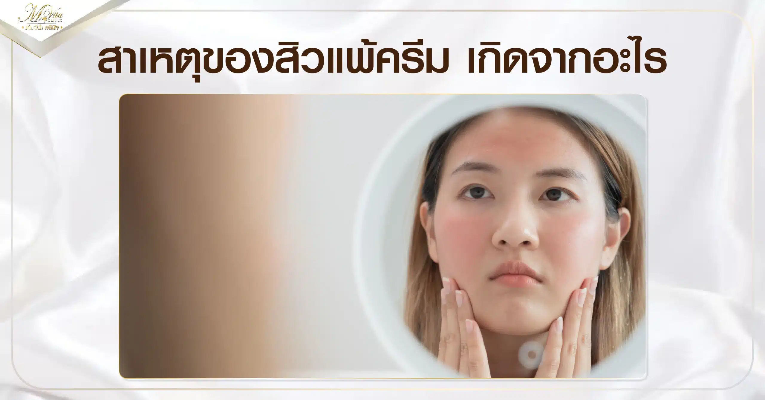 สาเหตุของสิวแพ้ครีม เกิดจากอะไร