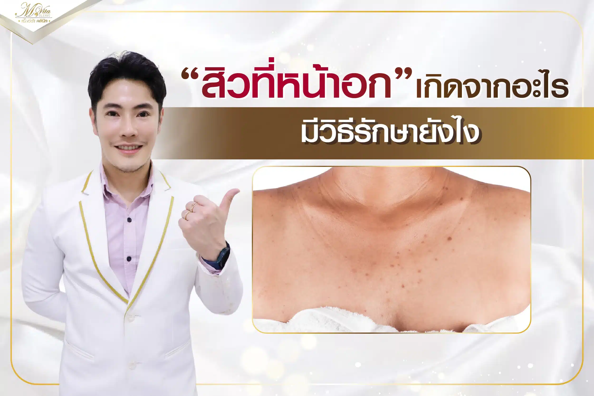 เรียนรู้เรื่องสิวที่หน้าอก พร้อมวิธีรักษาที่ได้ผลลัพธ์ดี