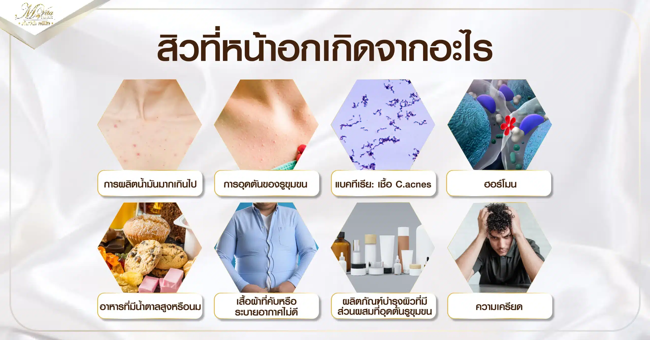 สิวที่หน้าอกเกิดจากอะไร