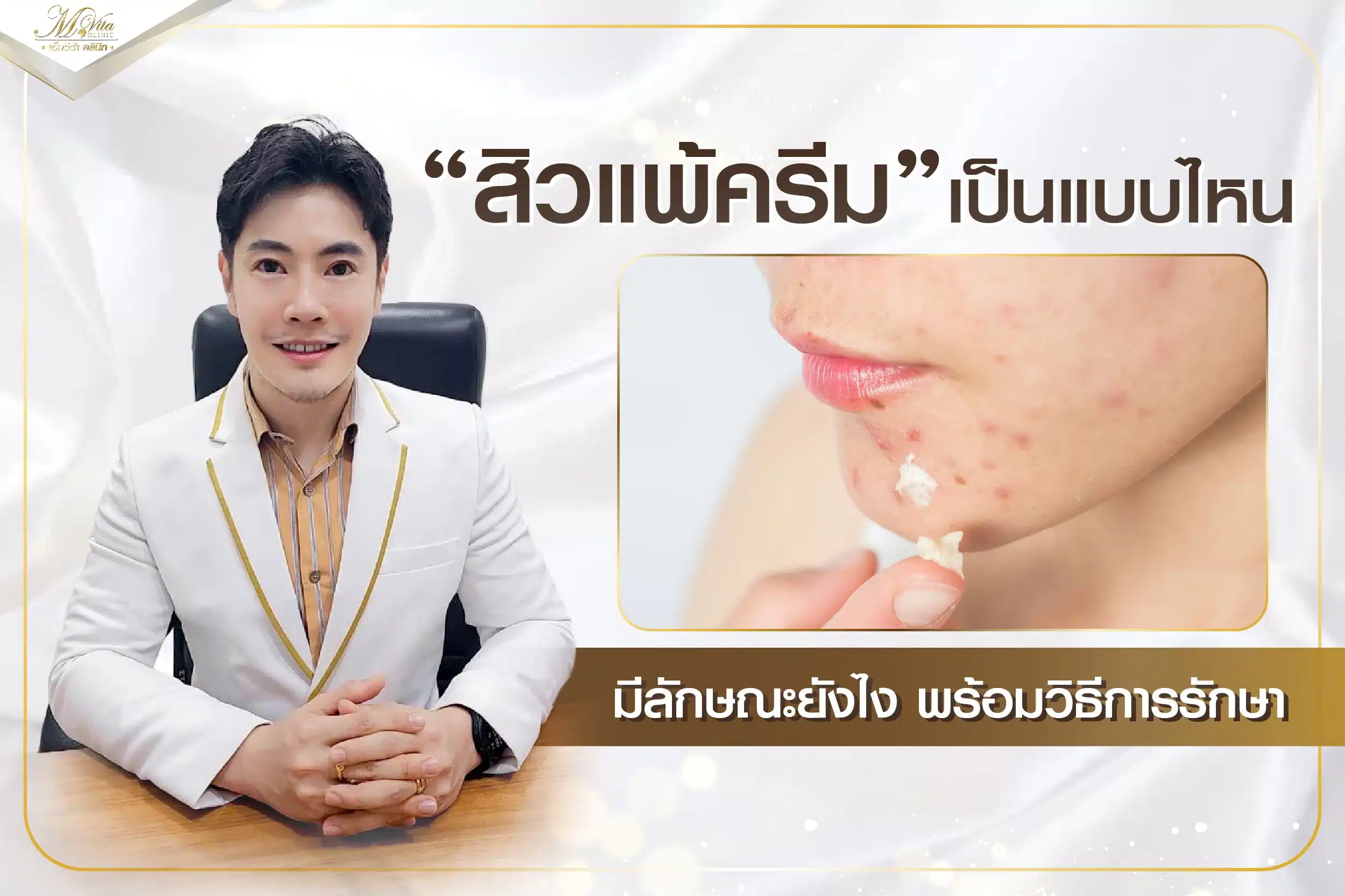 สิวแพ้ครีมทำยังไงให้หาย? สาเหตุและวิธีรักษาเบื้องต้น