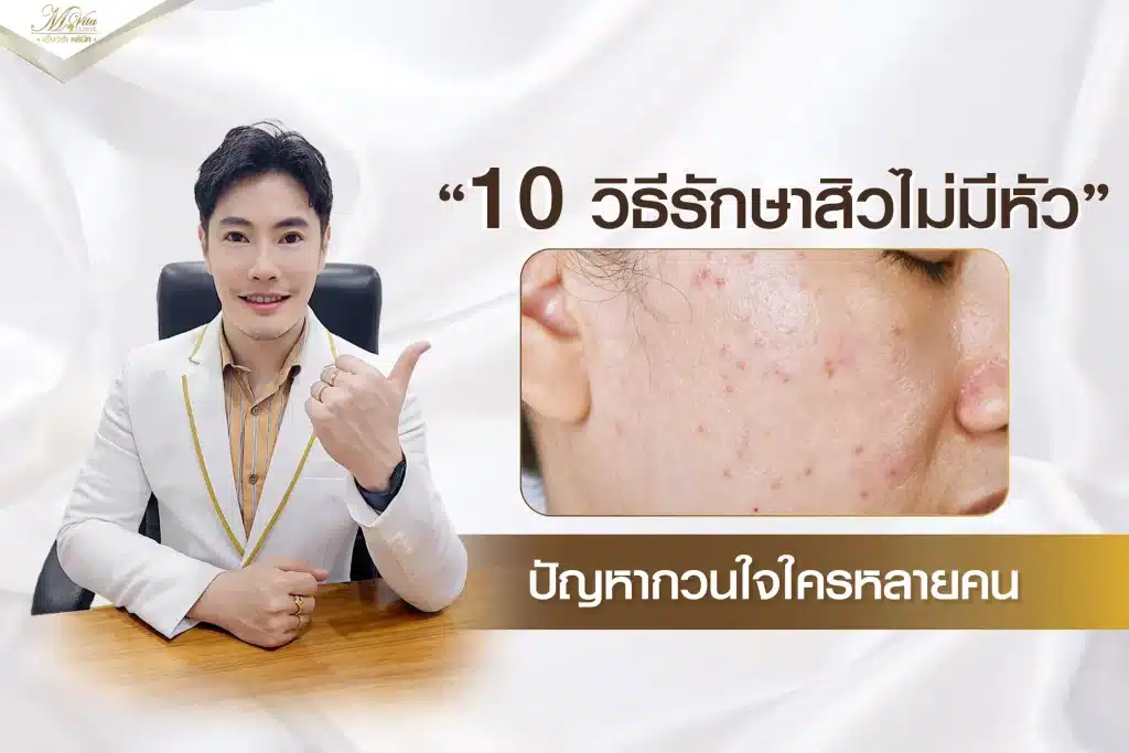 10 วิธีรักษาสิวไม่มีหัว