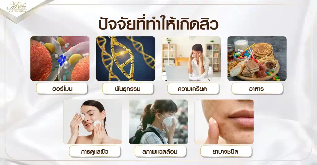 ปัจจัยที่ทำให้เกิดสิว