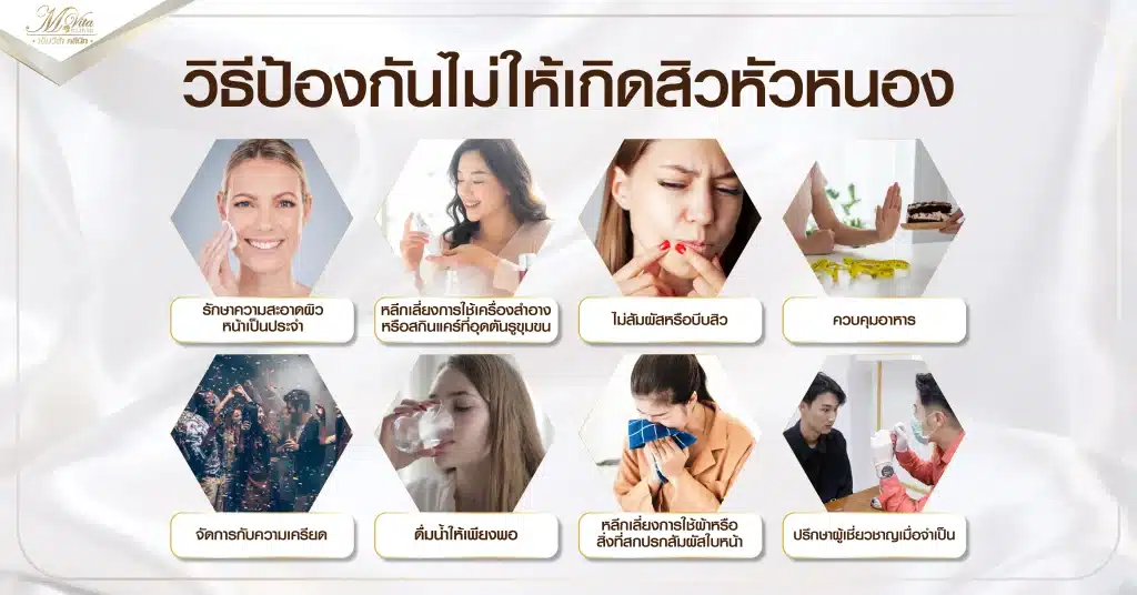 วิธีป้องกันไม่ให้เกิดสิวหัวหนอง