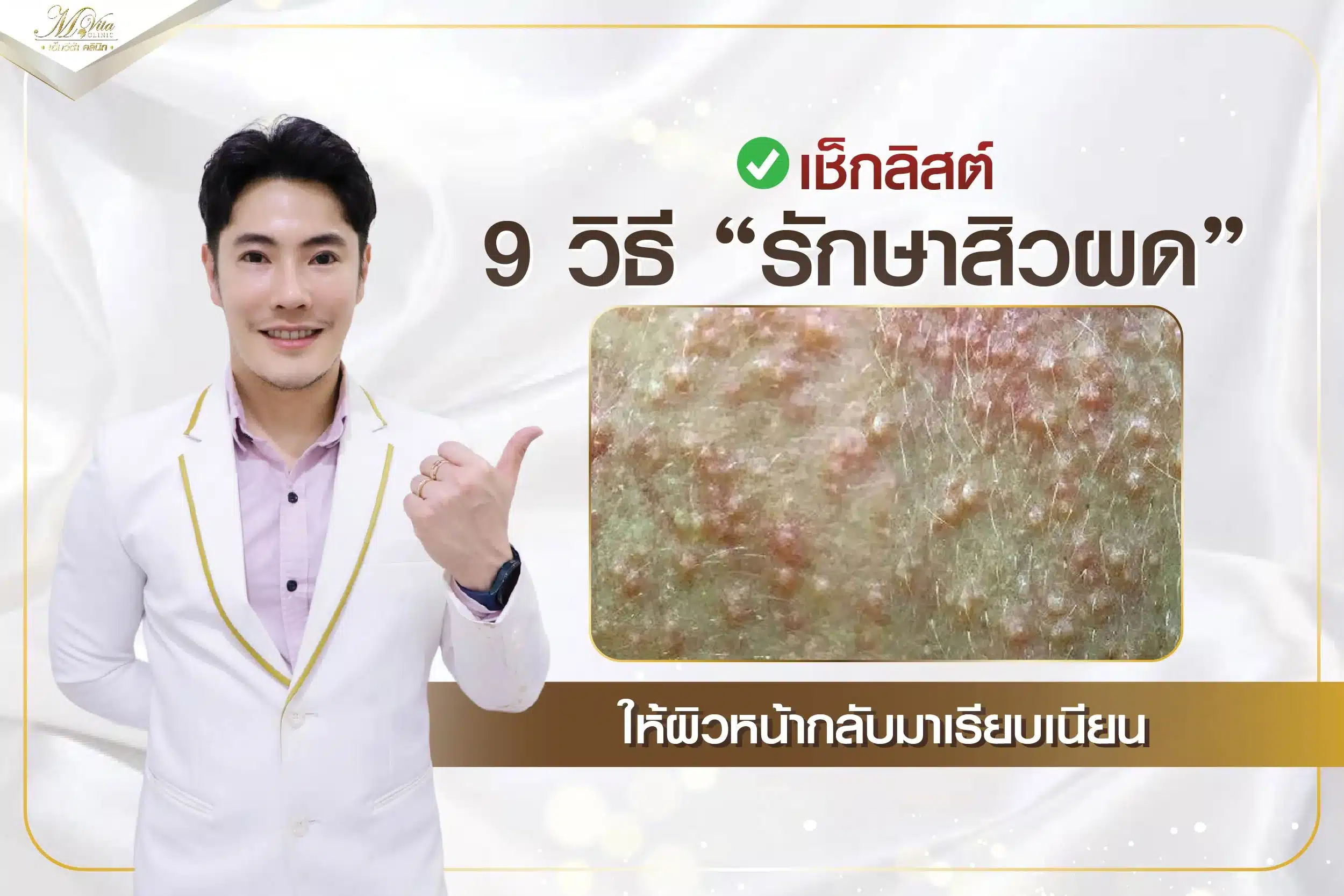 เช็กลิสต์ 9 วิธีรักษาสิวผด ให้ผิวหน้ากลับมาเรียบเนียน