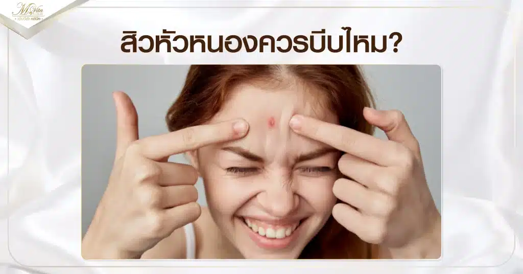 สิวหัวหนองเกิดจากอะไร