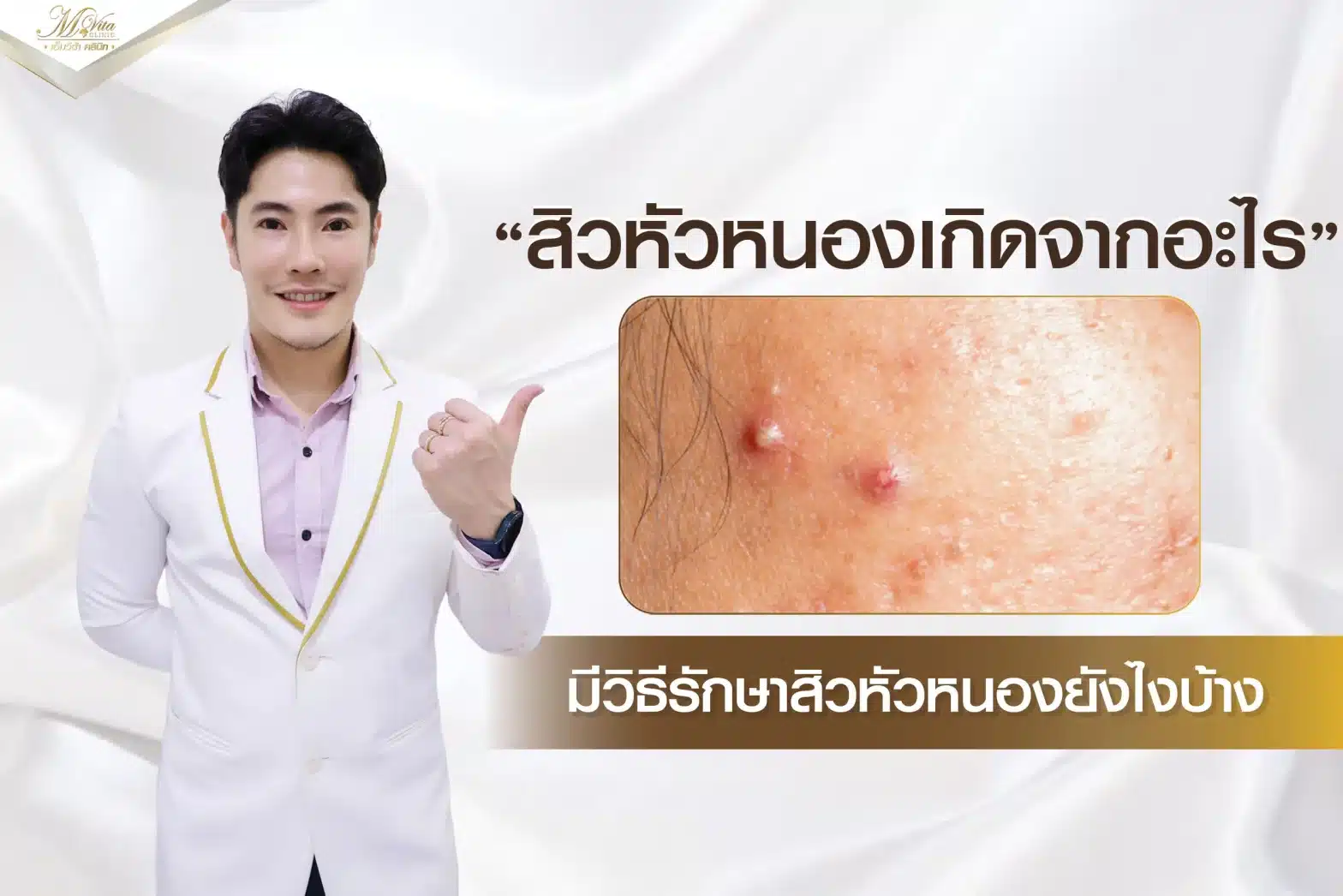 สิวหัวหนองเกิดจากอะไร