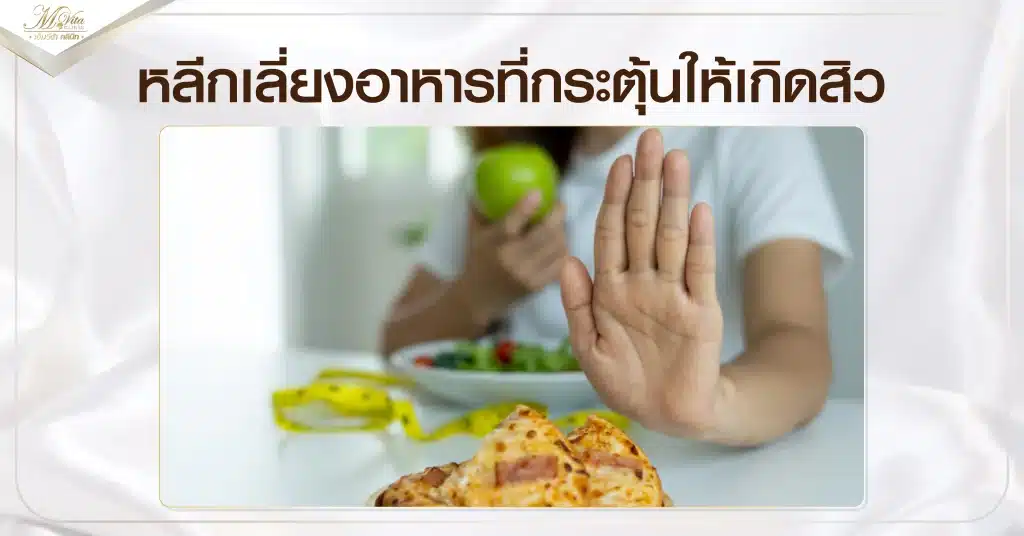 หลีกเลี่ยงอาหารที่กระตุ้นให้เกิดสิว