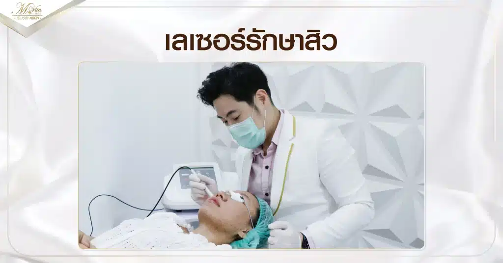 เลเซอร์รักษาสิว