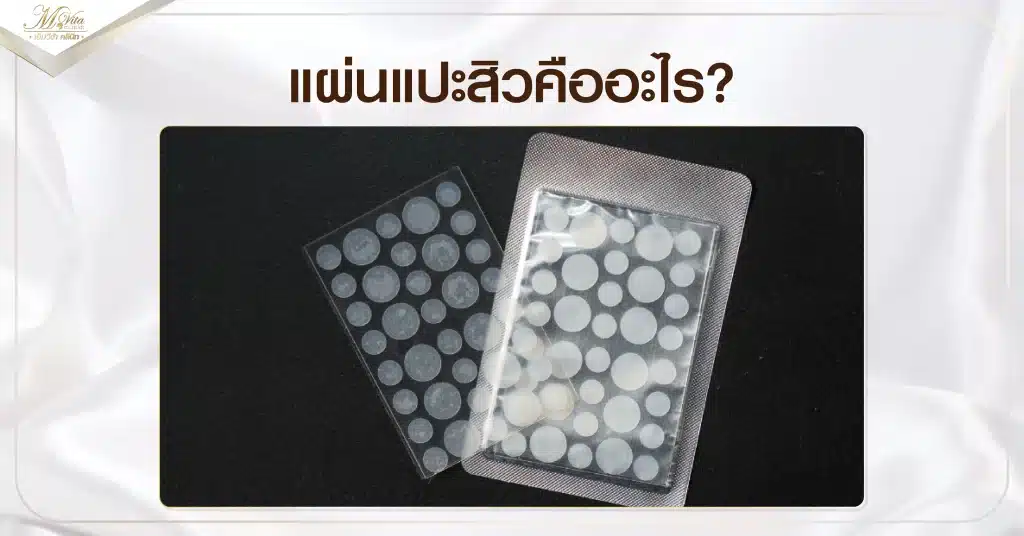 แผ่นแปะสิวคืออะไร