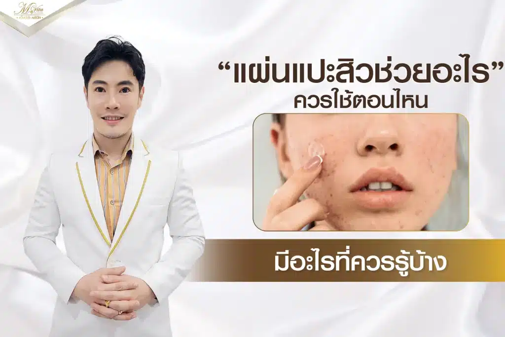 แผ่นแปะสิวช่วยอะไร