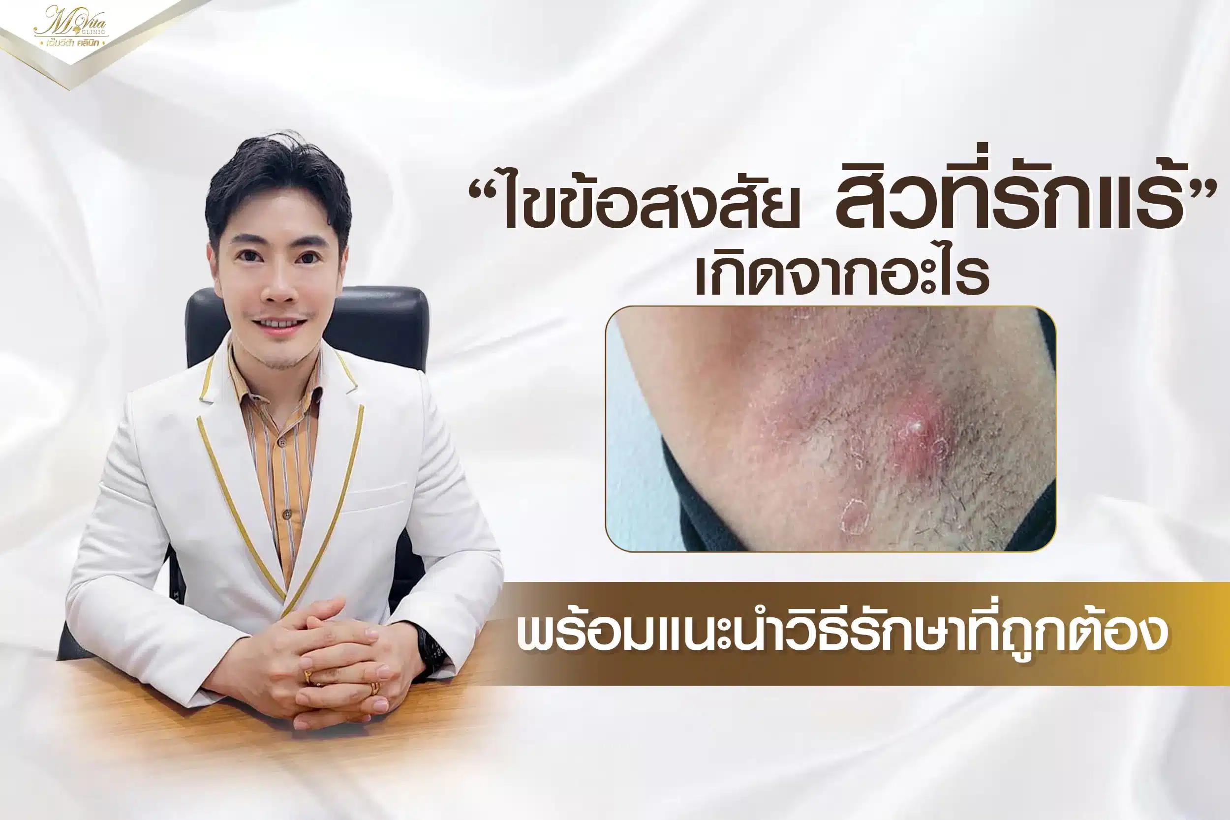 ไขข้อสงสัย สิวที่รักแร้เกิดจากอะไร พร้อมแนะนำวิธีรักษาที่ถูกต้อง