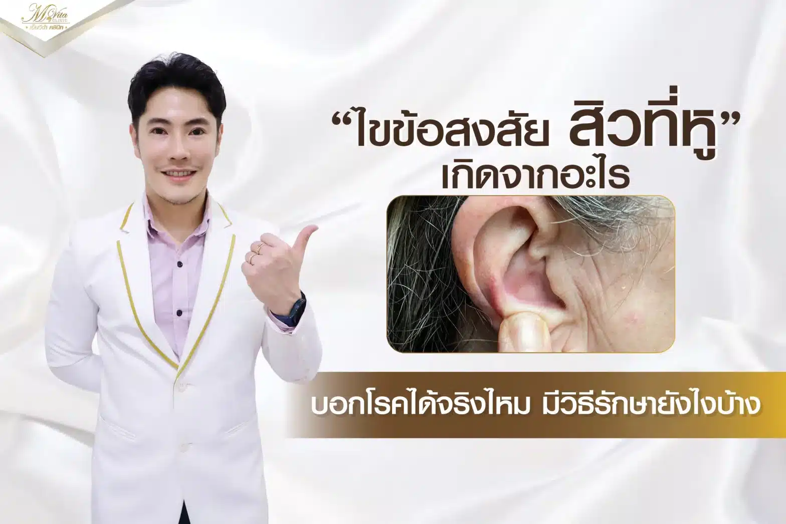 ไขข้อสงสัย สิวที่หู