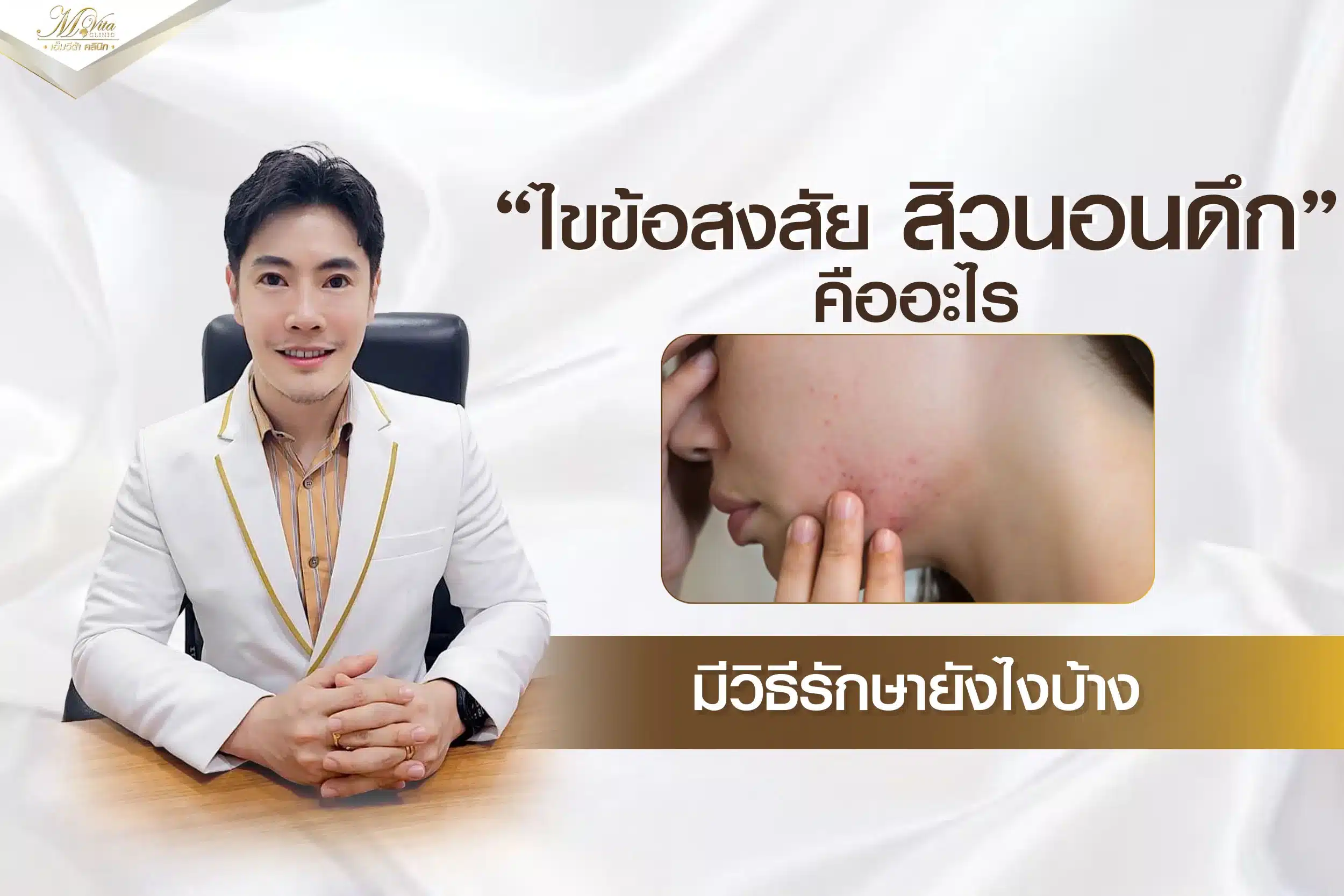 ไขข้อสงสัย สิวนอนดึกคืออะไร มีวิธีรักษายังไงบ้าง