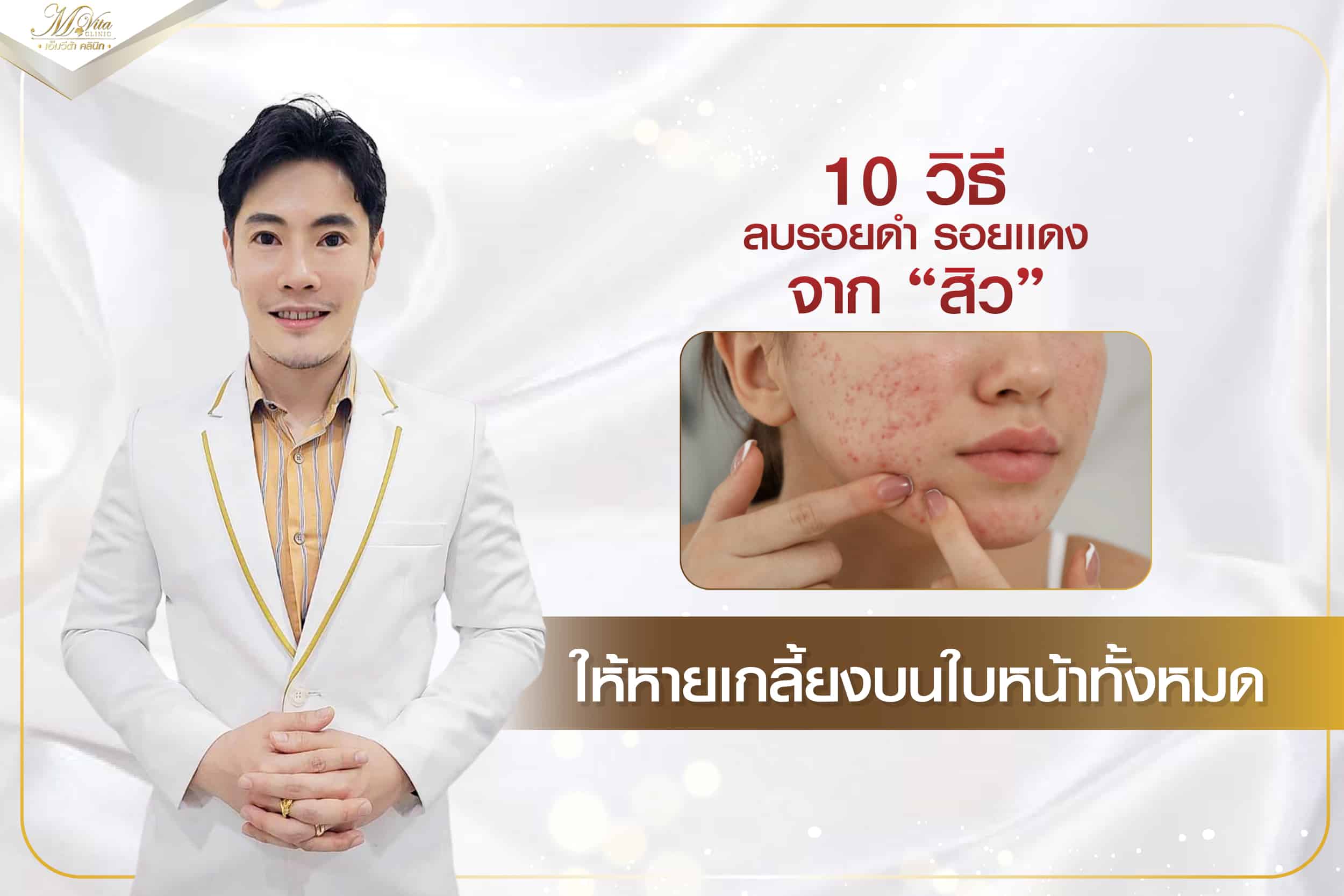 10 วิธีลบรอยดำ รอยแดง จากสิว ให้หายเกลี้ยงบนใบหน้าทั้งหมด