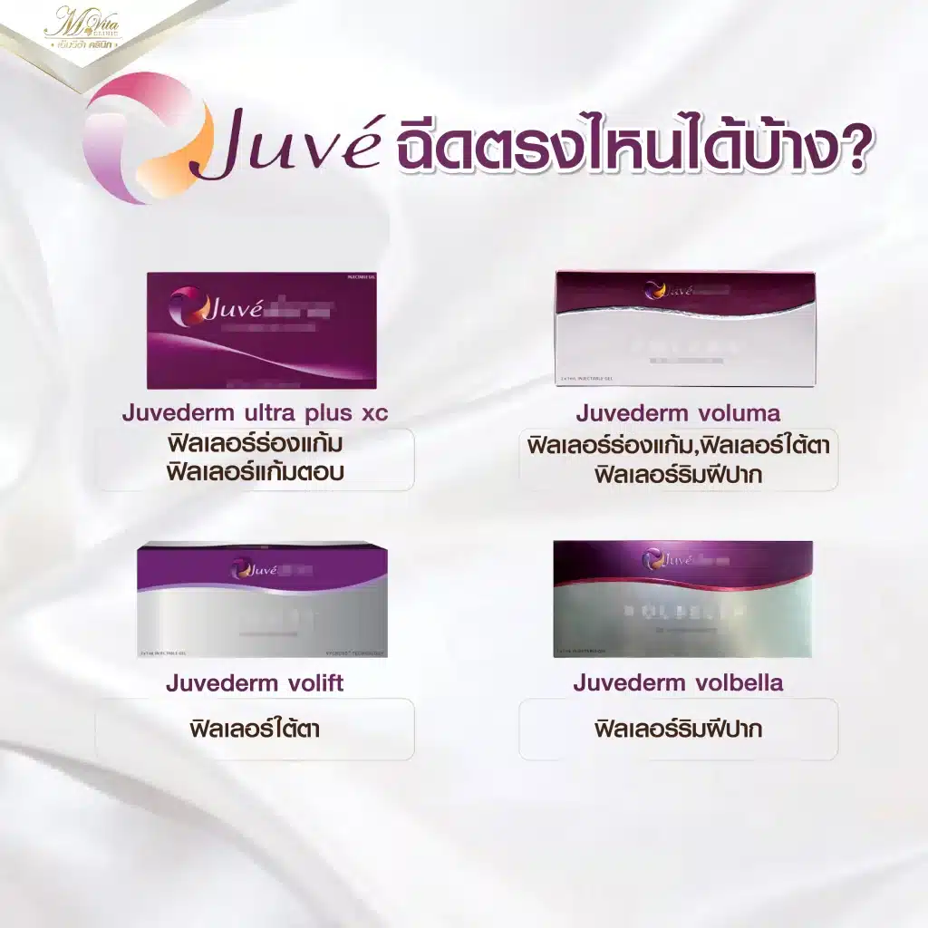 Juvederm ฉีดตรงไหนบ้าง