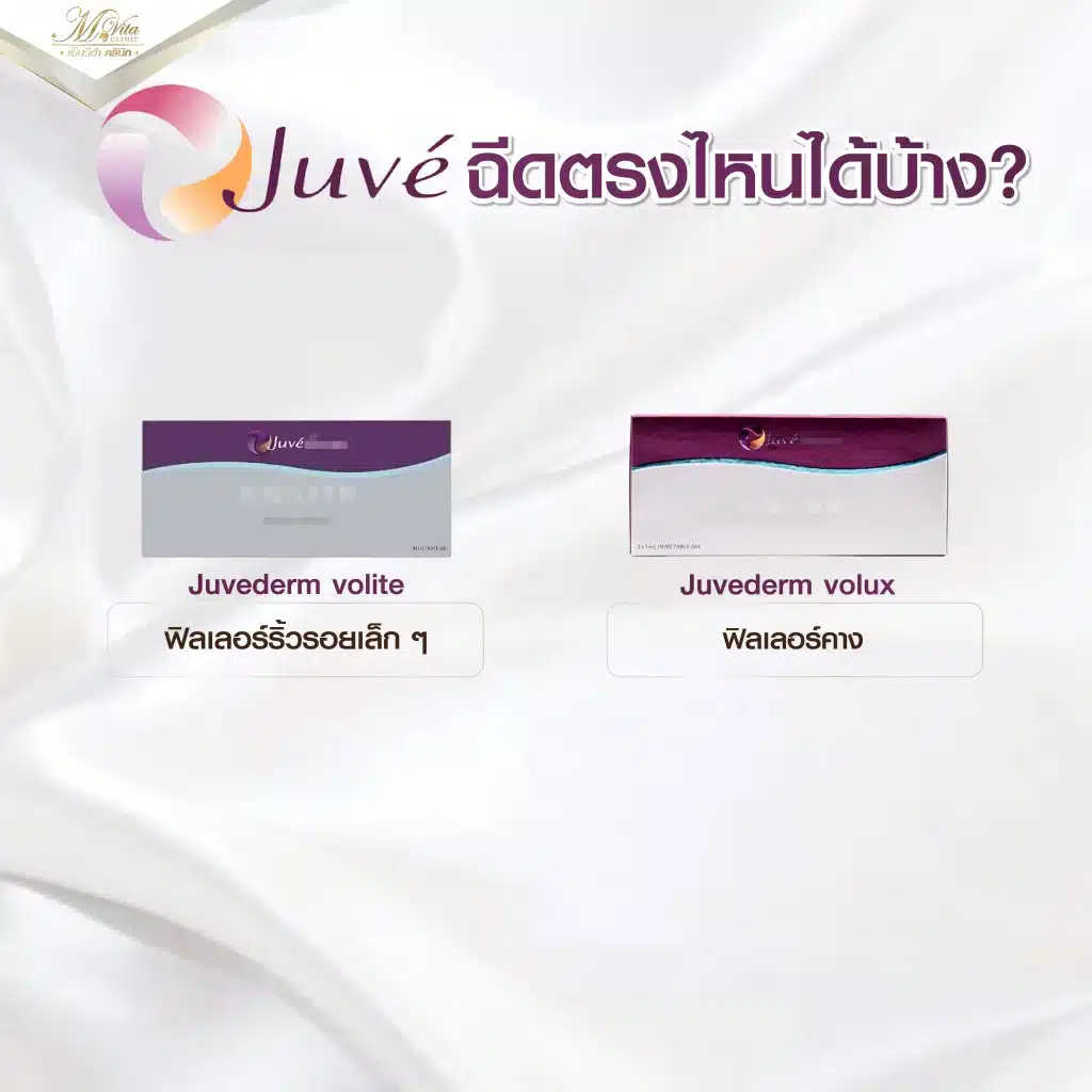 Juvederm ฉีดตรงไหนบ้าง2