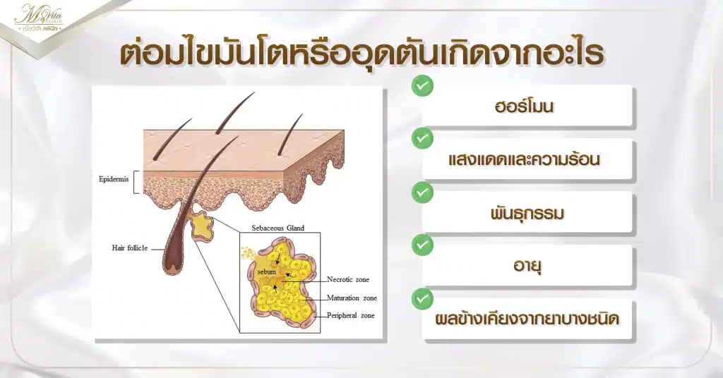 ต่อมไขมันโตหรืออุดตันเกิดจากอะไร