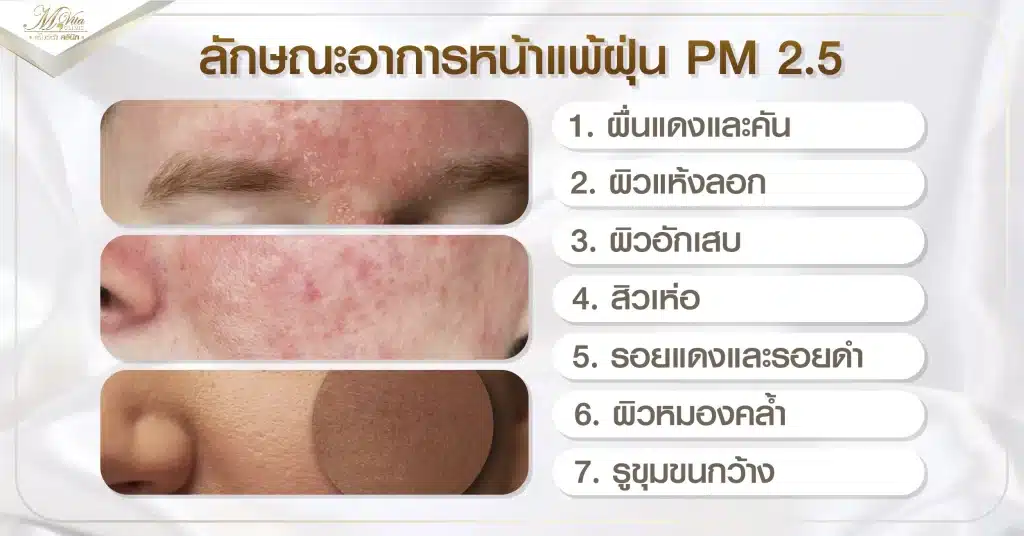 ลักษณะแพ้ฝุ่น PM2.5